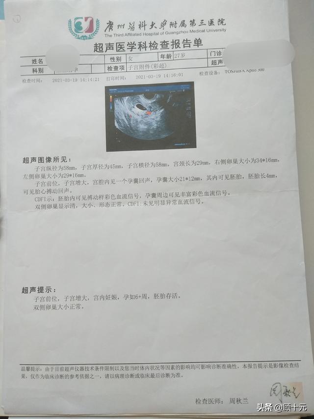 做试管婴儿的全部流程费用 做试管婴儿的全部流程费用