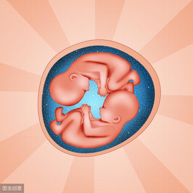 试管婴儿双胎 试管婴儿双胎