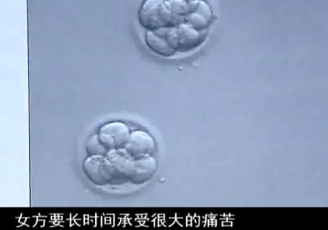 太监试管婴儿 太监试管婴儿