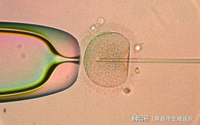 哪家试管婴儿(试管婴儿哪家医院最好)