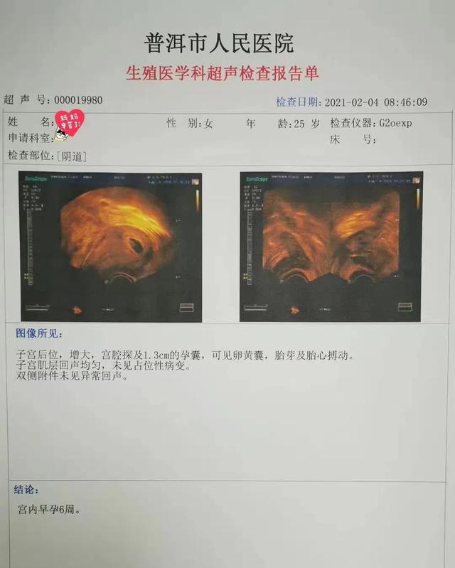 云南哪个医院试管婴儿 云南哪个医院试管婴儿