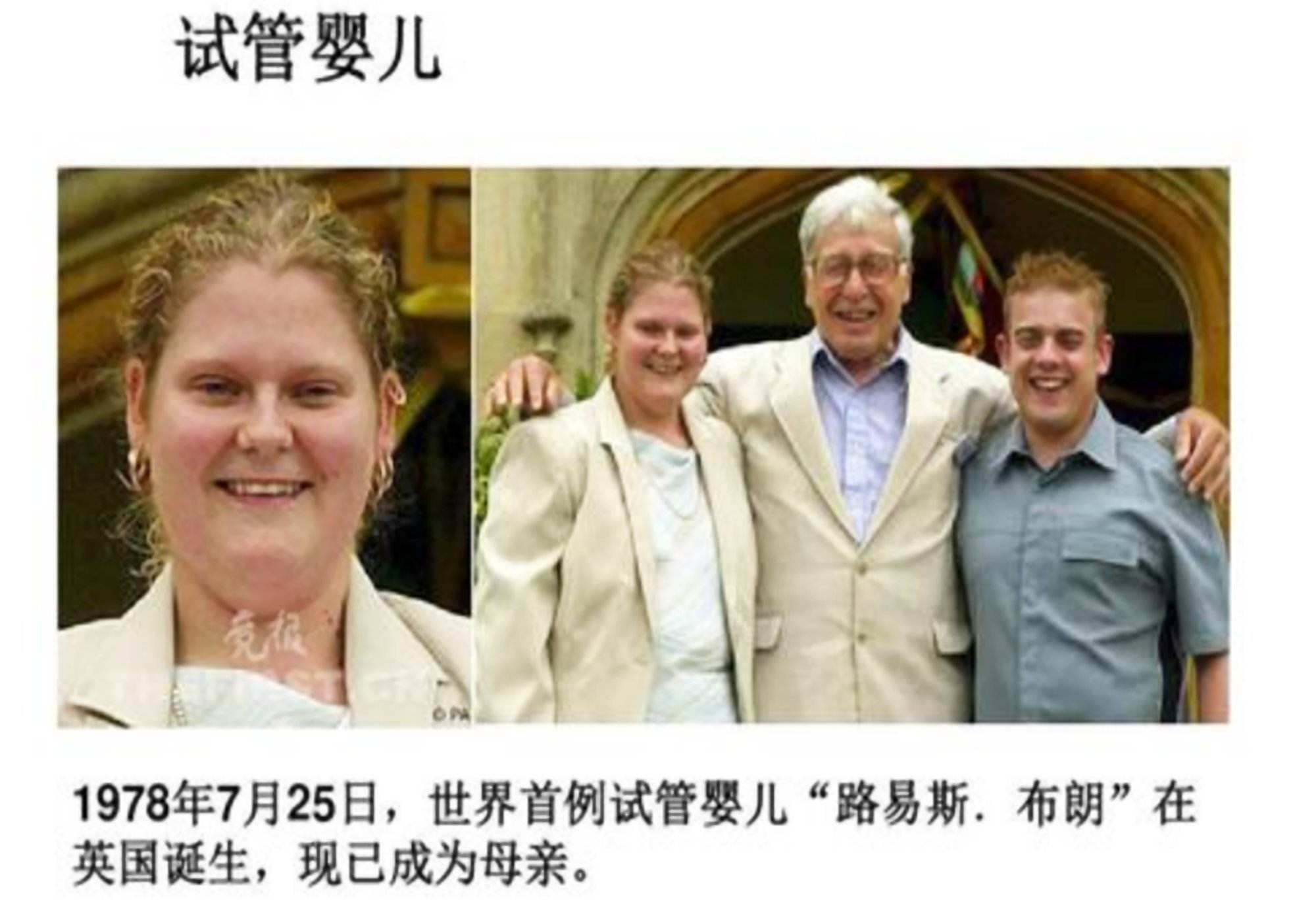 第一试管婴儿出生什么叫试管婴儿