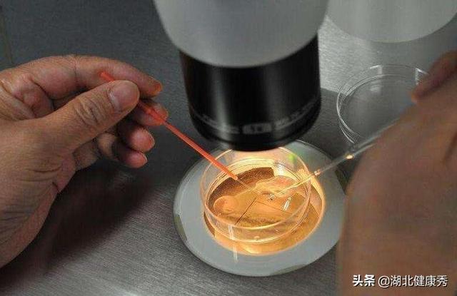 试管婴儿取卵后 试管婴儿取卵后