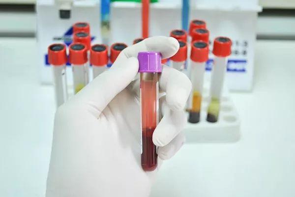 试管婴儿怀孕血值 试管婴儿怀孕血值
