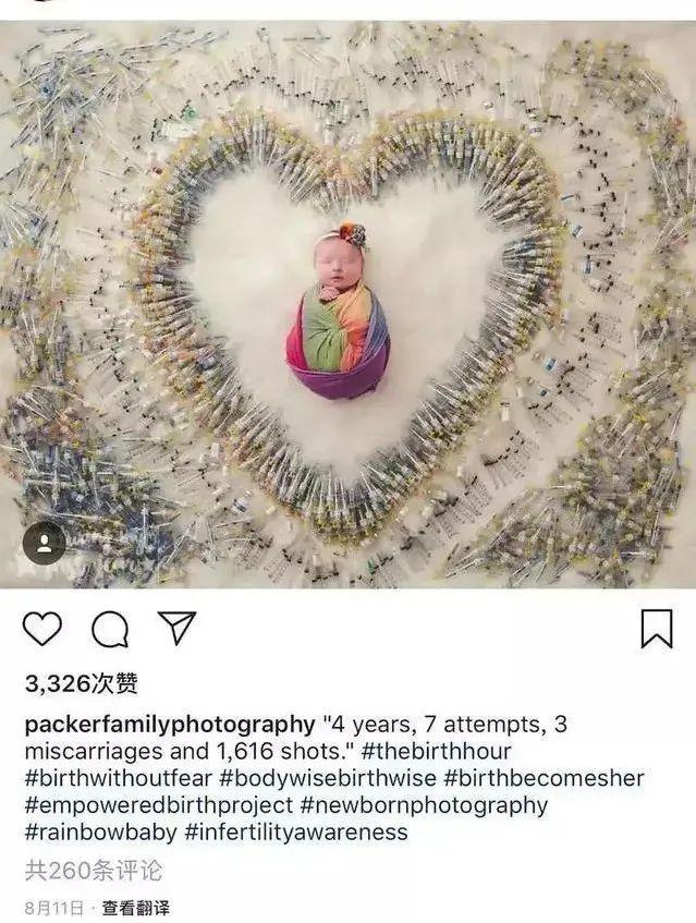 成都西囡三代试管婴儿 成都西囡三代试管婴儿