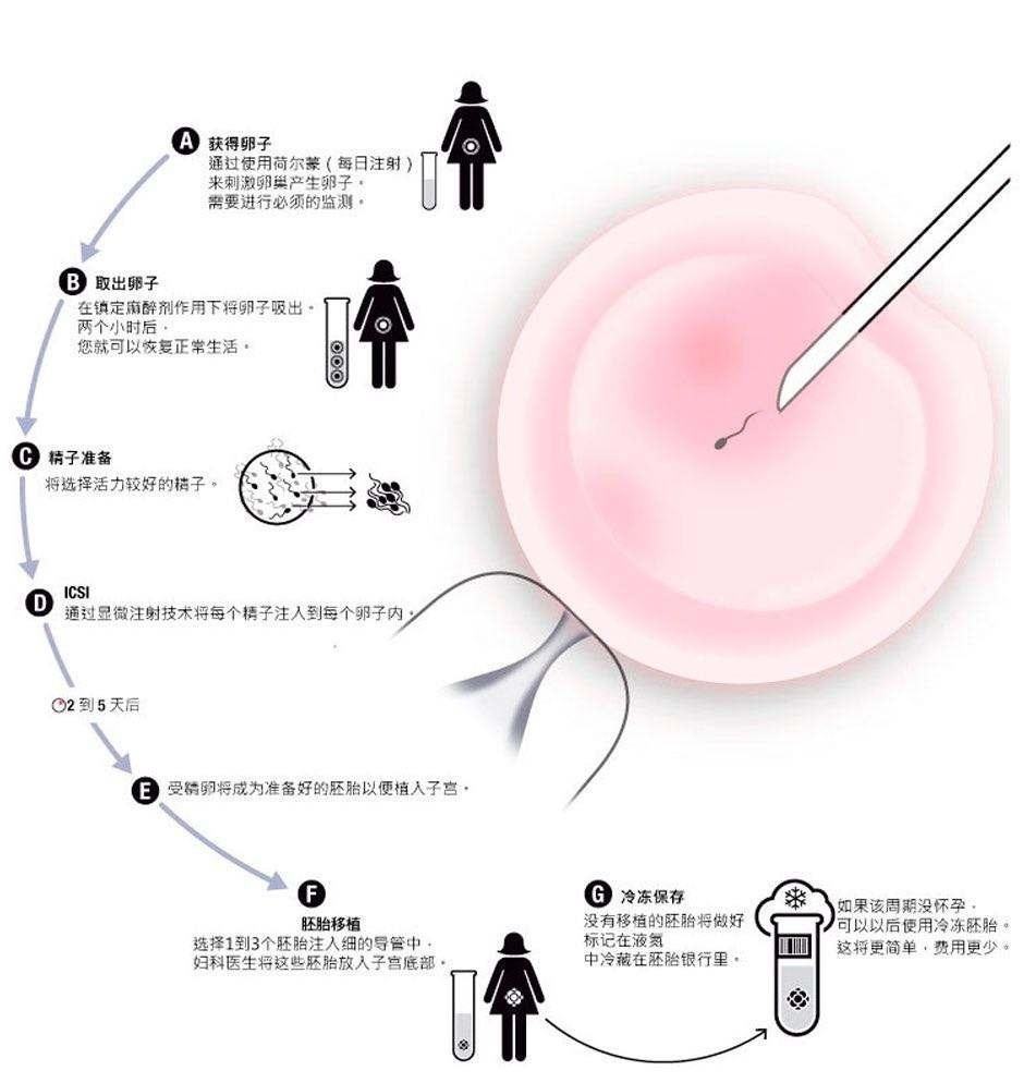 贵阳第三代试管婴儿真后悔做试管婴儿