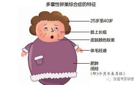 多囊卵巢可以试管婴儿吗 多囊卵巢可以试管婴儿吗