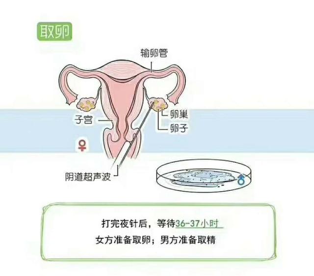 北医三院试管婴儿费用