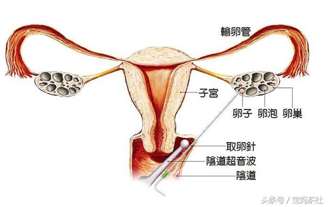 做试管婴儿一胎大概多少钱