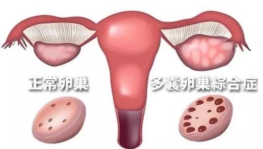 试管婴儿移植后几天能测出怀孕