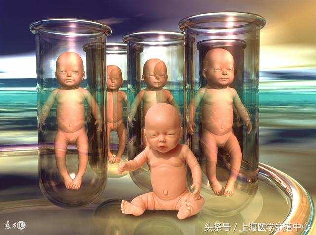 试管婴儿上海医院