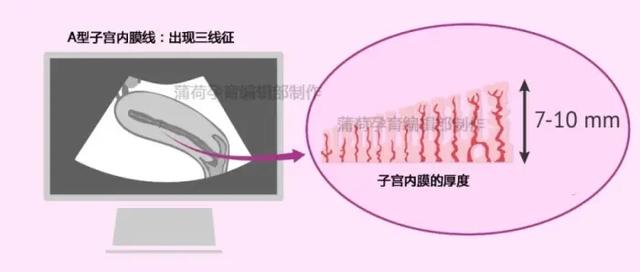 做试管婴儿的长方案