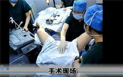 试管婴儿痛 试管婴儿痛