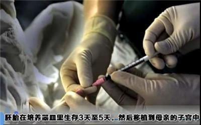 试管婴儿痛 试管婴儿痛