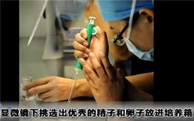试管婴儿痛 试管婴儿痛