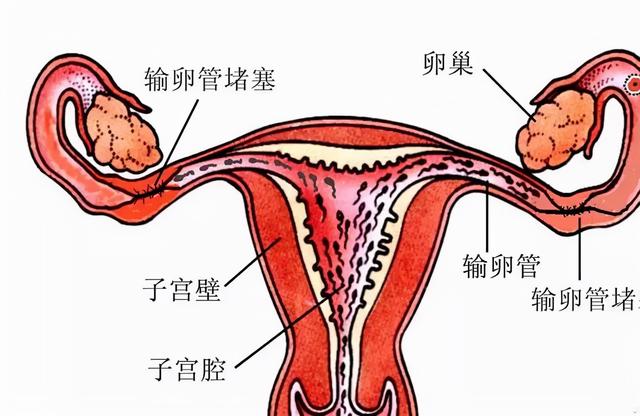试管婴儿管试管婴儿怎么做的全过程