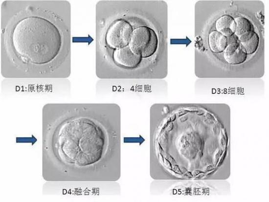 试管婴儿胚胎是4BB试管婴儿花费