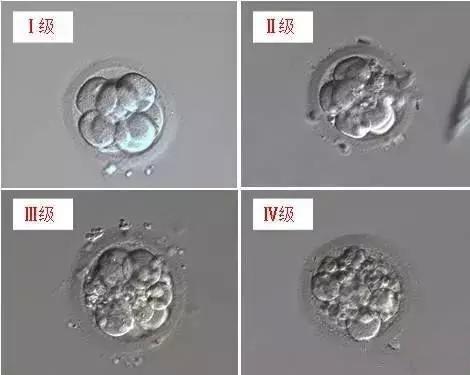 试管婴儿胚胎是4BB 试管婴儿胚胎是4BB