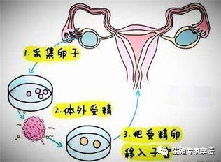 试管婴儿是怎么样的 试管婴儿是怎么样的