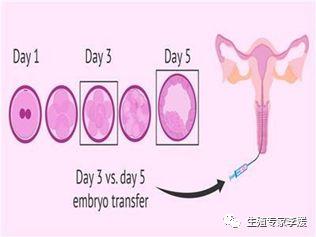 试管婴儿是怎么样的 试管婴儿是怎么样的