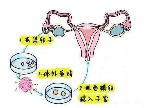 试管婴儿多吗试管婴儿产检有不同吗