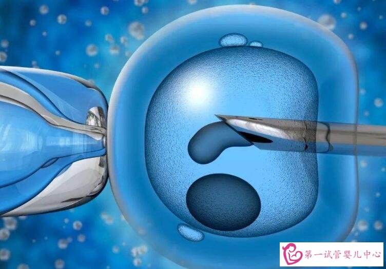 云南试管婴儿多少钱(试管婴儿全下来多少钱)
