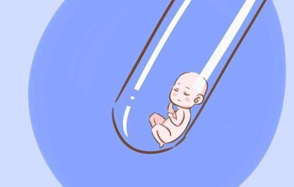 试管婴儿智力 试管婴儿智力