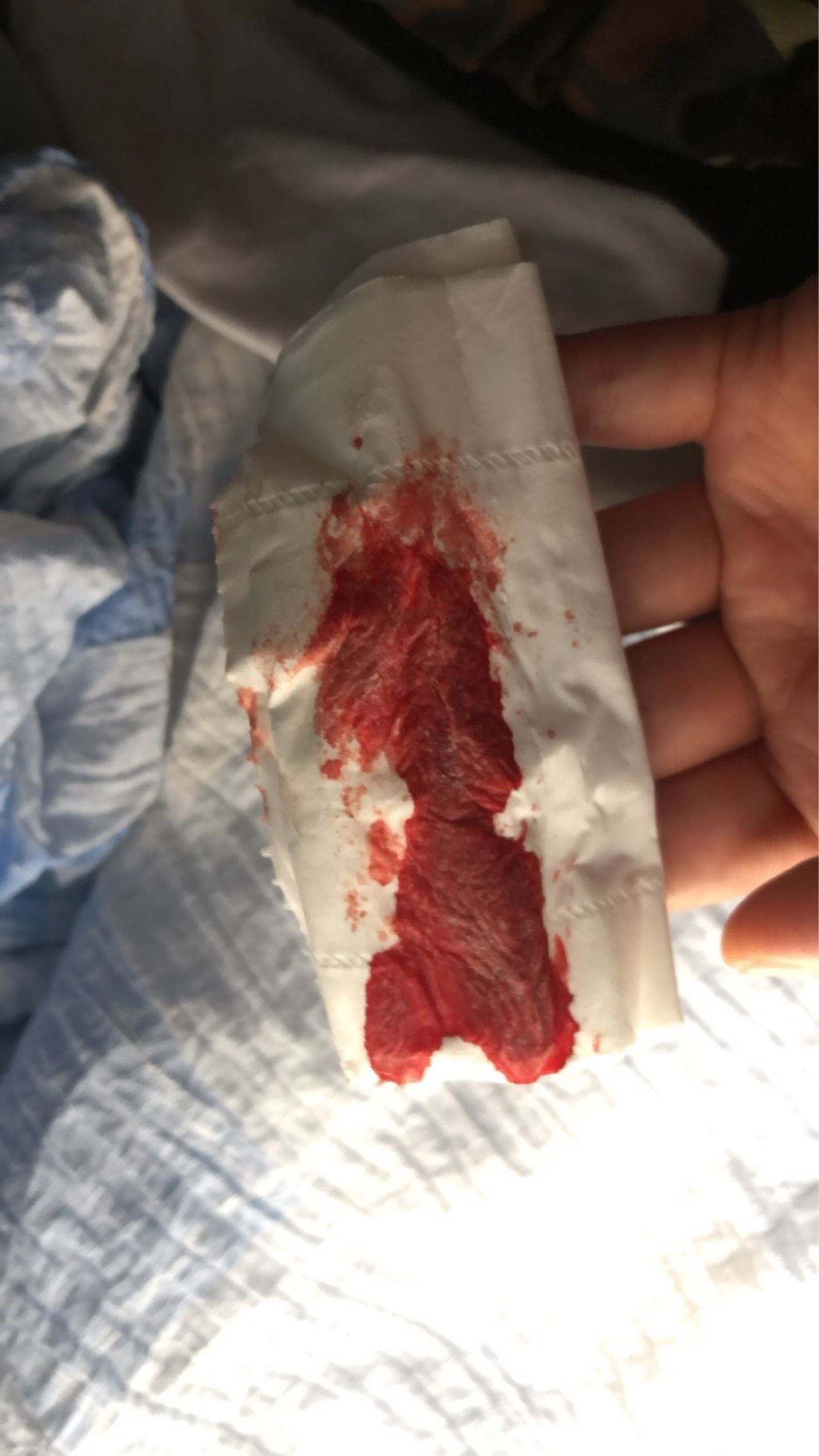 试管婴儿播种网(试管婴儿播种网app最新版)