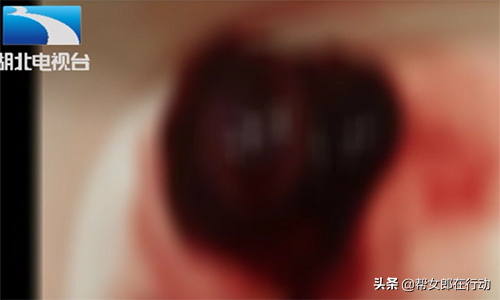 汉阳试管婴儿 汉阳试管婴儿