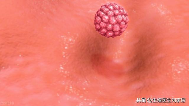 试管婴儿短方案是什么 试管婴儿短方案是什么