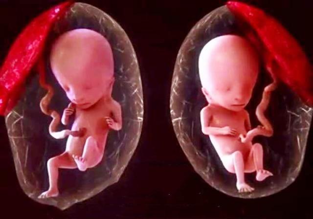 试管婴儿后自然怀孕