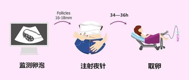 试管婴儿什么促排卵 试管婴儿什么促排卵