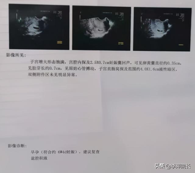 没有问题能做试管婴儿吗 没有问题能做试管婴儿吗