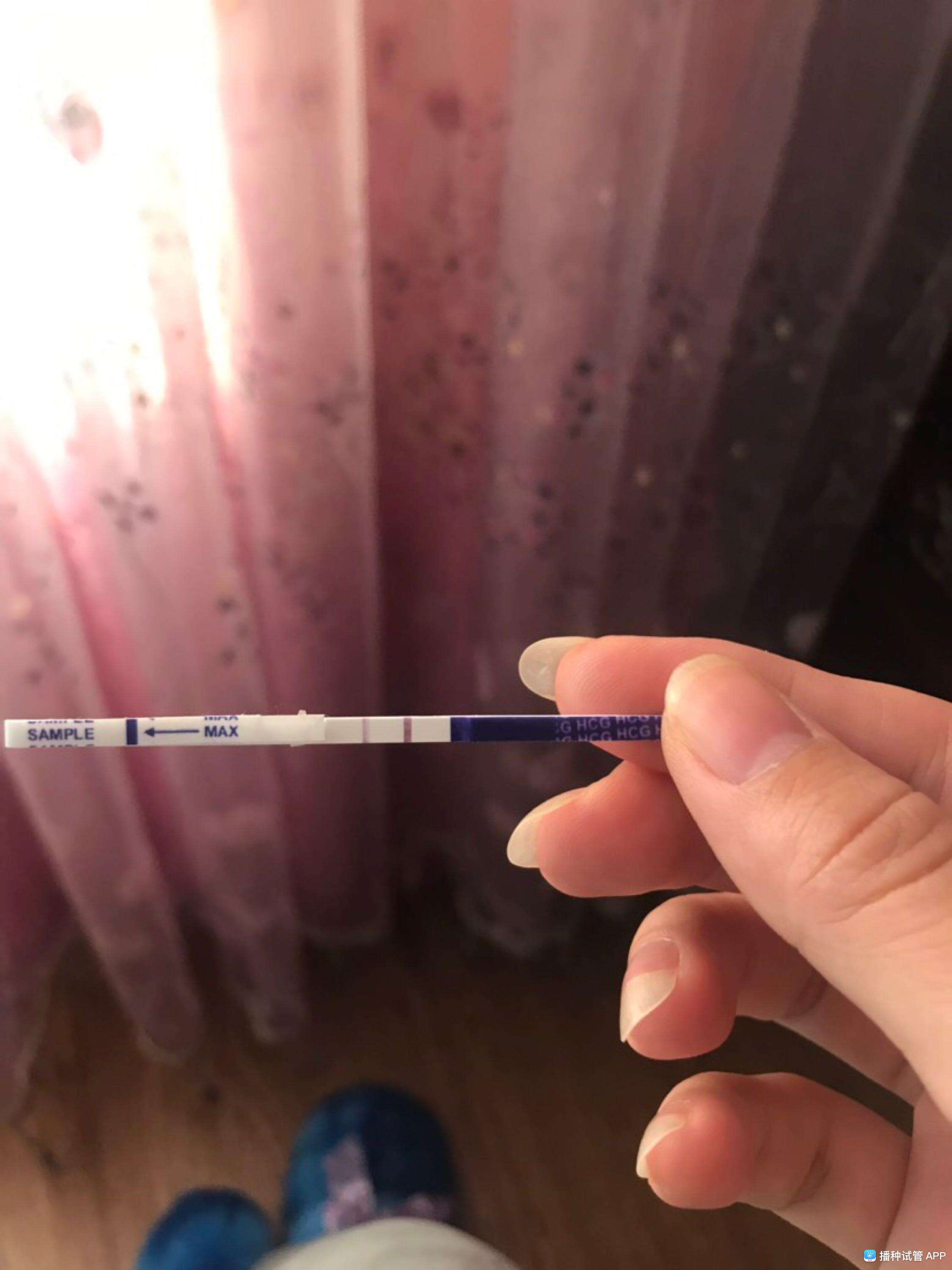 试管婴儿囊胚移植(试管10个囊胚成功案例)