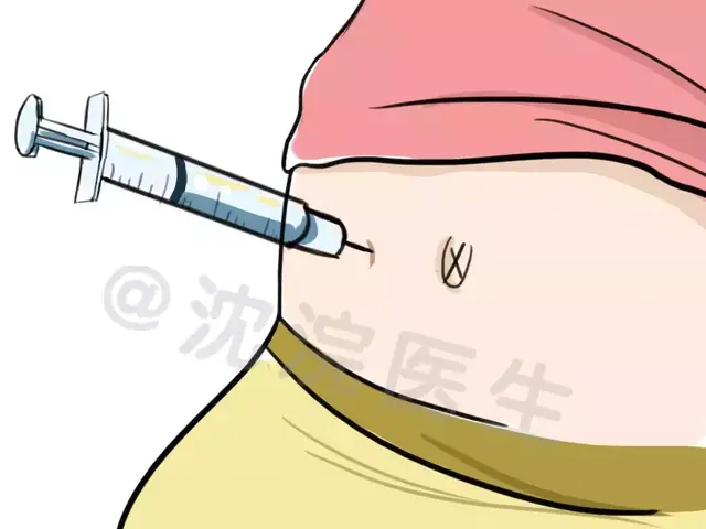 试管婴儿打针 试管婴儿打针