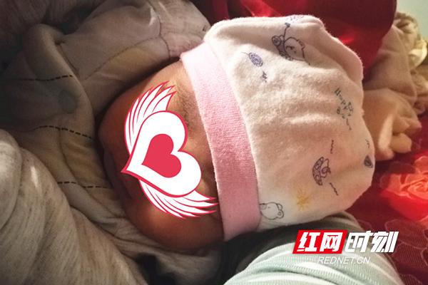 子宫腺肌症试管婴儿子宫腺肌症会自愈吗