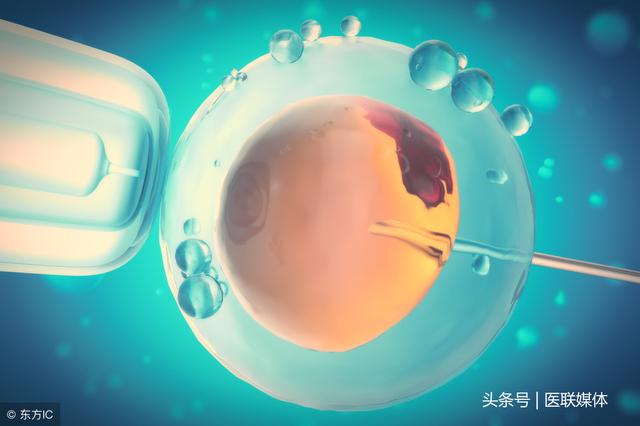 试管婴儿要移植(试管婴儿能决定男女吗)