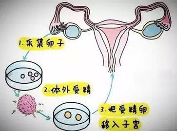 北医三院试管婴儿成功率 北医三院试管婴儿成功率