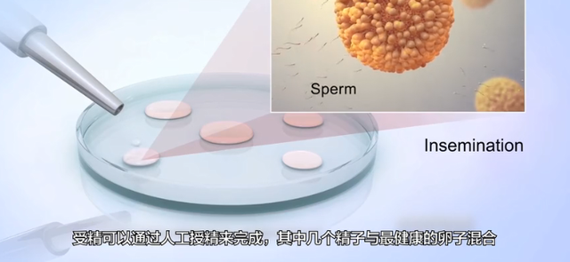 美国试管婴儿费用 美国试管婴儿费用