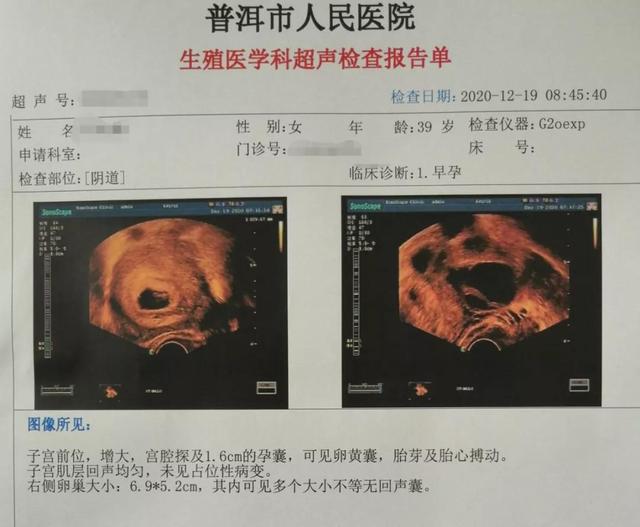 省人民医院做试管婴儿 省人民医院做试管婴儿