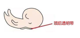 试管婴儿nt 试管婴儿nt
