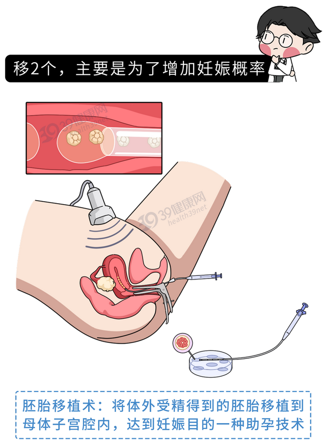试管婴儿心得 试管婴儿心得