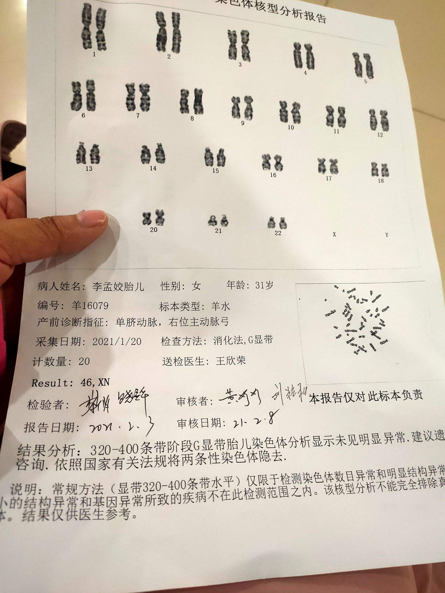 羊水穿刺试管婴儿(试管一定要做羊穿吗)