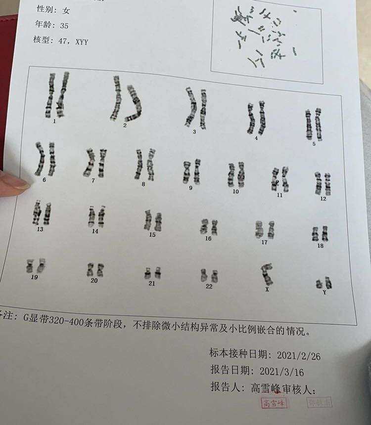 羊水穿刺试管婴儿(试管一定要做羊穿吗)