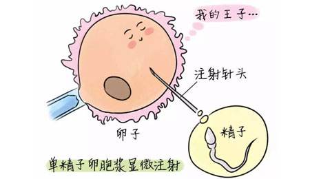 试管婴儿授精人工受孕5大副作用