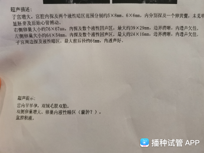 盆腔积液可以做试管婴儿吗盆腔积液20mm影响移植吗