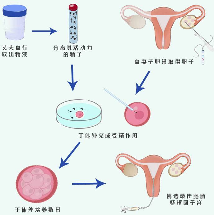 试管婴儿容易出血为什么试管双胎都流血