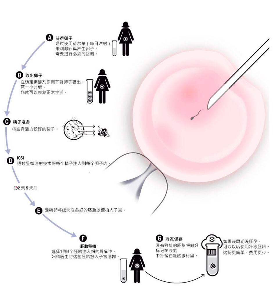 试管婴儿一次大概费用试管婴儿成功一共花了多少钱