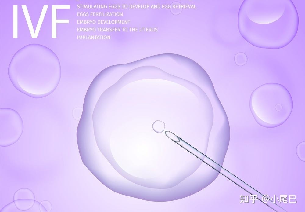结扎能不能做试管婴儿(男性结扎可以做试管婴儿吗)