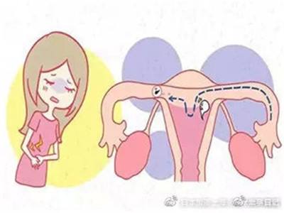 女人做试管婴儿后遗症为什么不建议女性做试管婴儿